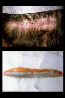 Hair transplantation, Strip technique, Best Plastic Surgery, Nile Cosmetic Center, FUE