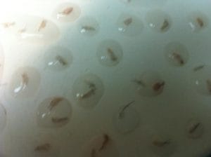 FUE Follicular Units Extraction close up at Best Cosmetic Surgery at Nile Cosmetic Center