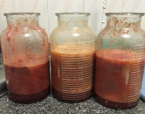 Abdominal Vaser High Definition 4D Liposculpture at Best Plastic Surgery in Egypt and breast Reduction Mastopexy Fat sucked out