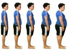 Morbid Obesity, Weight Loss surgery, Sleeve Gastrectomy, Best Plastic Surgery, Nile Cosmetic Center