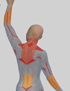 4 DimensionalmHigh Definition Vaser Smart Liposuction at Best Plastic Surgery Egypt, female back