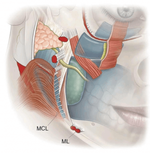 Buccal Pad of Fat causing Jowls removed at Best Plastic Surgery Egypt