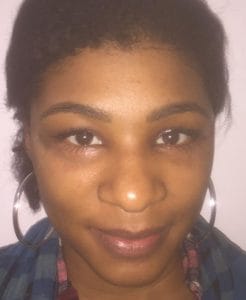 Cateye Eyelid blepharoplasty Eyelid Surgery and Cateye Blepharoplasty at Best Aesthetic Surgery in Egypt