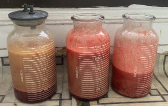 Fat Suction Abdominal Tummy Liposuction using Vaser Liposuction at Best Cosmetic surgery Egypt