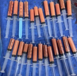 Nano Fat transfer for fat grafting in face and lips at Best plastic Surgery Egypt